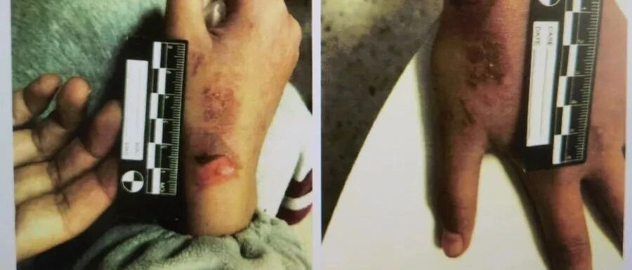 亲妈被撤销监护权，女儿直言：太开心!别让“望女成凤”变成“走火入魔”