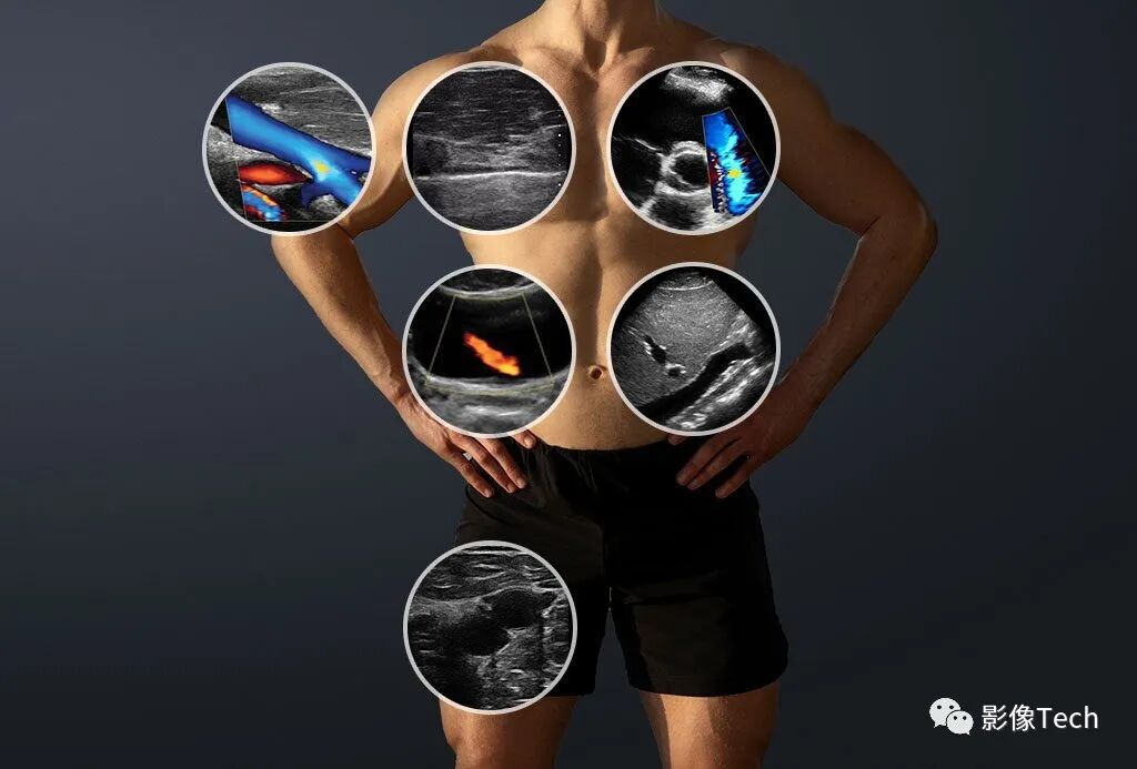 med复制粘贴怎么移动Clarius Mobile Health ：首款！双阵列手持式无线超声扫描仪_https://www.jmylbn.com_新闻资讯_第4张