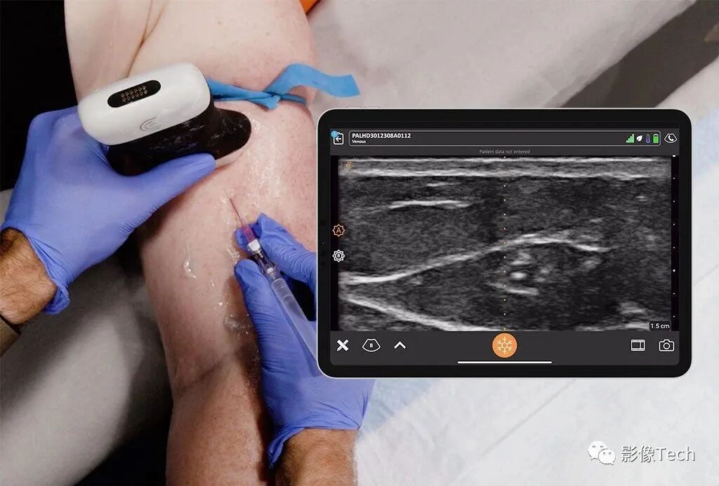 med复制粘贴怎么移动Clarius Mobile Health ：首款！双阵列手持式无线超声扫描仪_https://www.jmylbn.com_新闻资讯_第5张