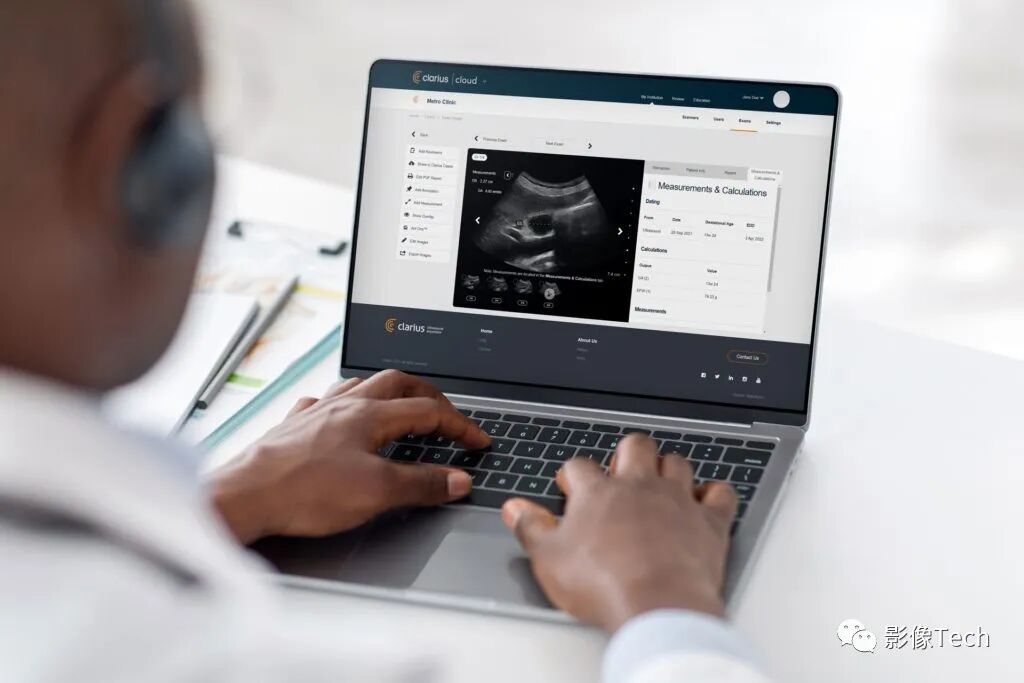 med复制粘贴怎么移动Clarius Mobile Health ：首款！双阵列手持式无线超声扫描仪_https://www.jmylbn.com_新闻资讯_第6张
