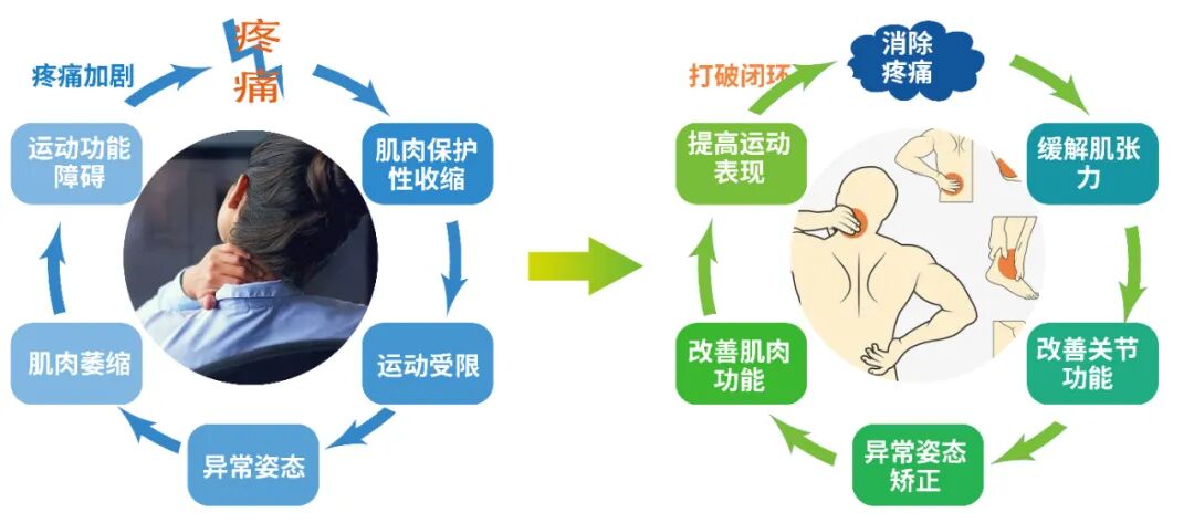 电磁治疗仪能治什么电磁式冲击波治疗仪——疼痛克星_https://www.jmylbn.com_新闻资讯_第4张