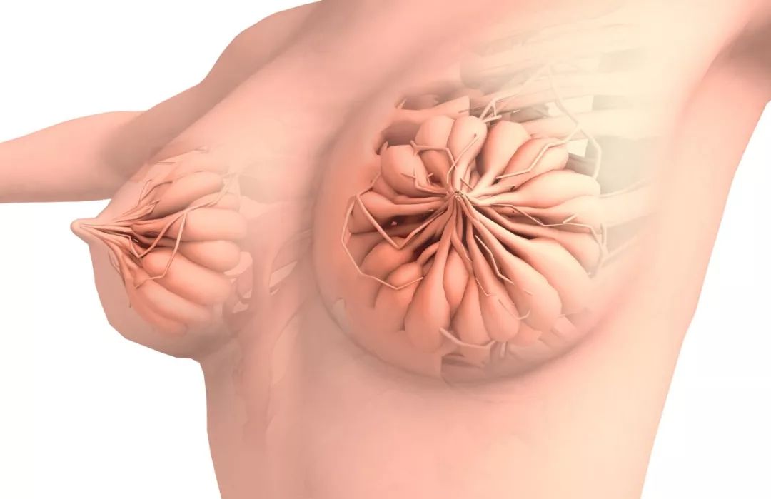 乳腺结节该如何应对？一分钟教你读懂“乳腺结节”的体检报告