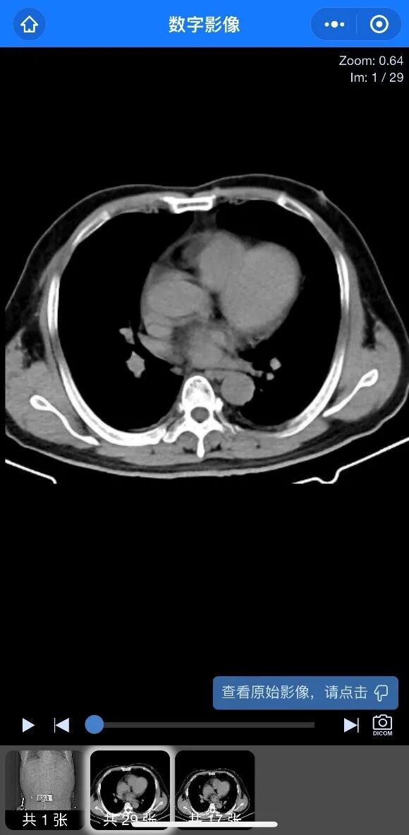 医用胶片怎么看我为群众办实事 ｜ 手机扫一扫，拍片结果随时随地看！我院“智能云胶片”让您体验便捷服务_https://www.jmylbn.com_新闻资讯_第8张