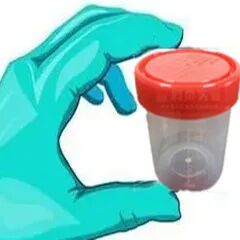 化验大便怎么采集【检验科普小知识】如何正确采集大、小便标本_https://www.jmylbn.com_新闻资讯_第6张