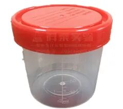 化验大便怎么采集【检验科普小知识】如何正确采集大、小便标本_https://www.jmylbn.com_新闻资讯_第9张