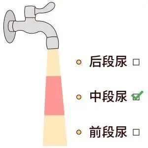 化验大便怎么采集【检验科普小知识】如何正确采集大、小便标本_https://www.jmylbn.com_新闻资讯_第10张