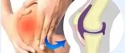 《J Mater Chem B》：干细胞关节再生术，在更短的时间内再生软骨组织