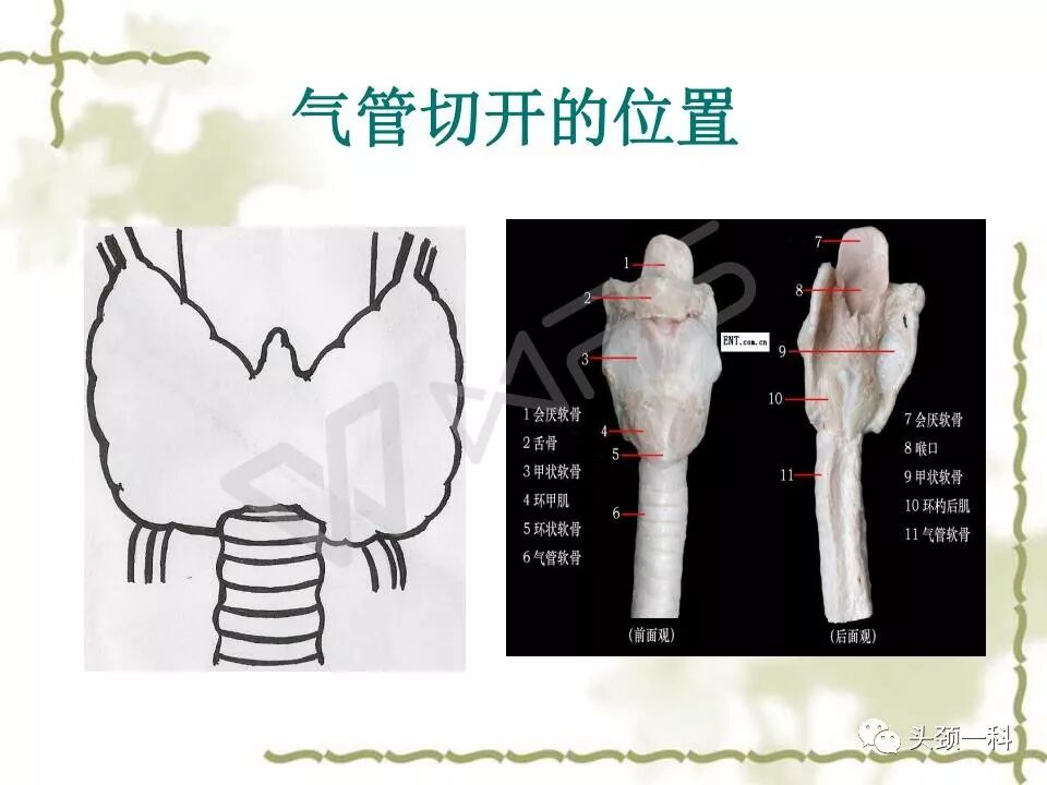 气管套管怎么换药您知道带着气管套管回家以后需要如何护理吗？_https://www.jmylbn.com_新闻资讯_第2张