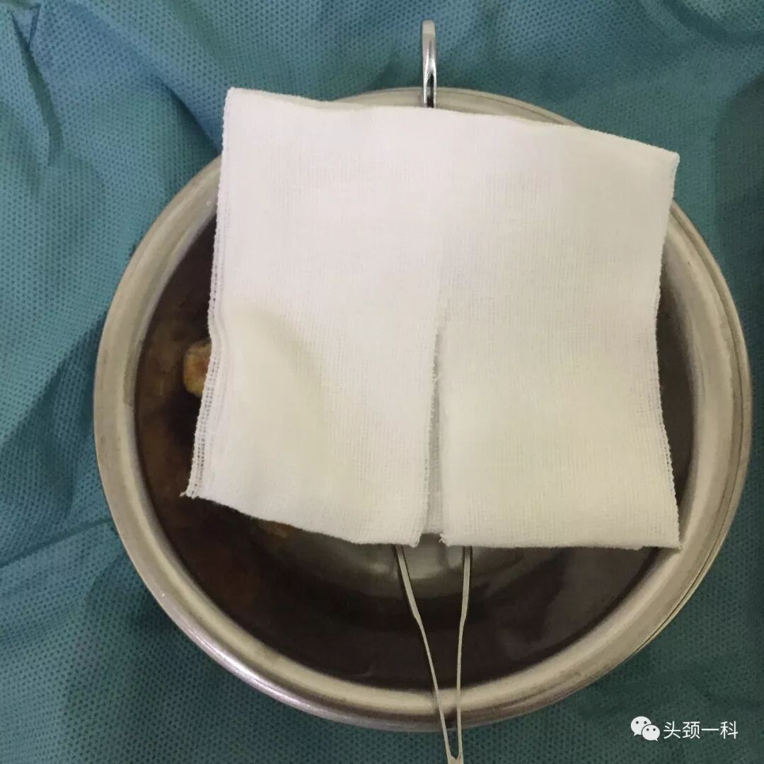 气管套管怎么换药您知道带着气管套管回家以后需要如何护理吗？_https://www.jmylbn.com_新闻资讯_第6张