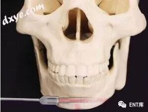 整形手术器械有什么面部骨骼整形手术实用指南 - 4. 面部骨手术的标准手术器械_https://www.jmylbn.com_新闻资讯_第6张