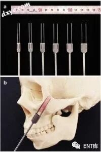 整形手术器械有什么面部骨骼整形手术实用指南 - 4. 面部骨手术的标准手术器械_https://www.jmylbn.com_新闻资讯_第3张