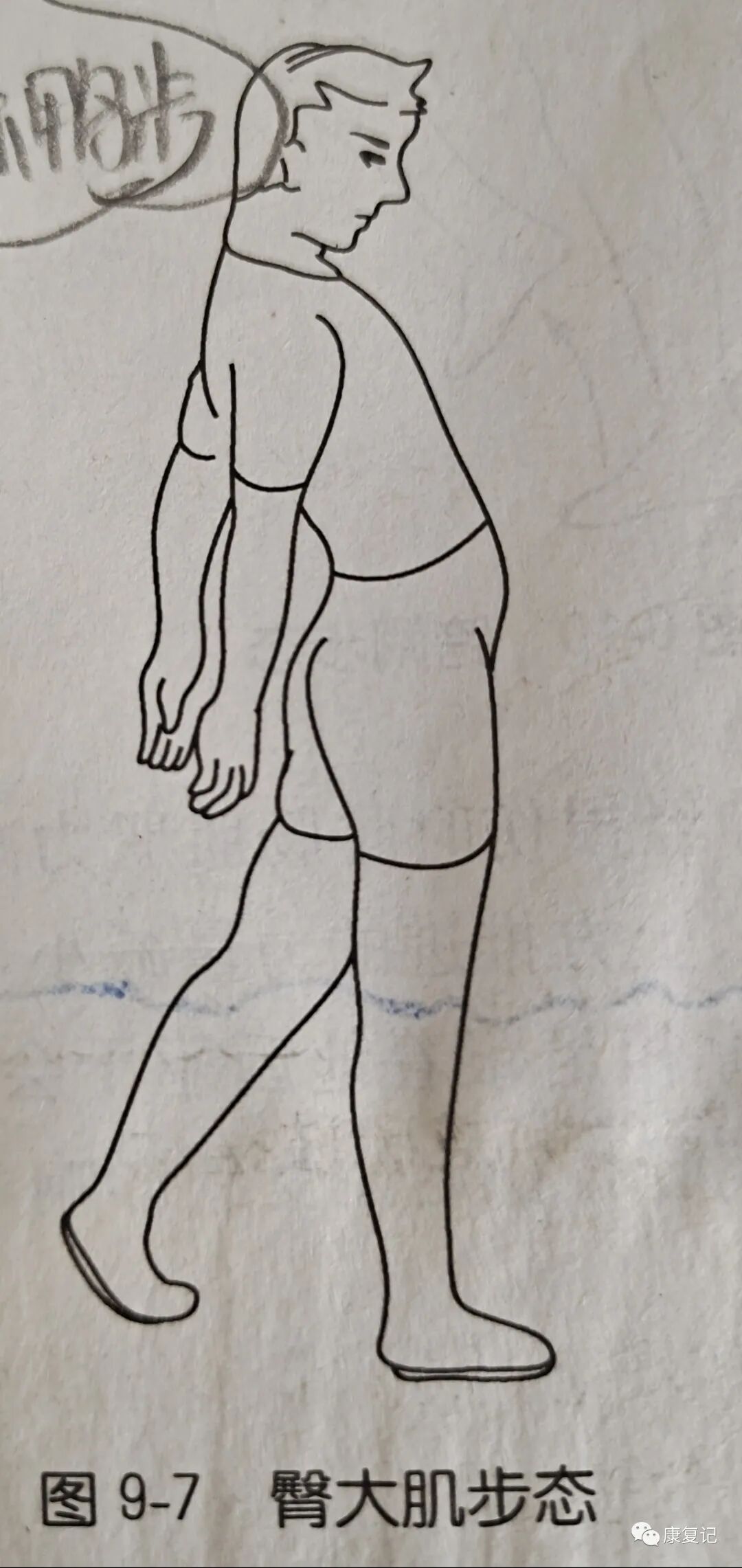 步态分析上曲线怎么解读康复知识点总结第47期——步态分析_https://www.jmylbn.com_新闻资讯_第8张