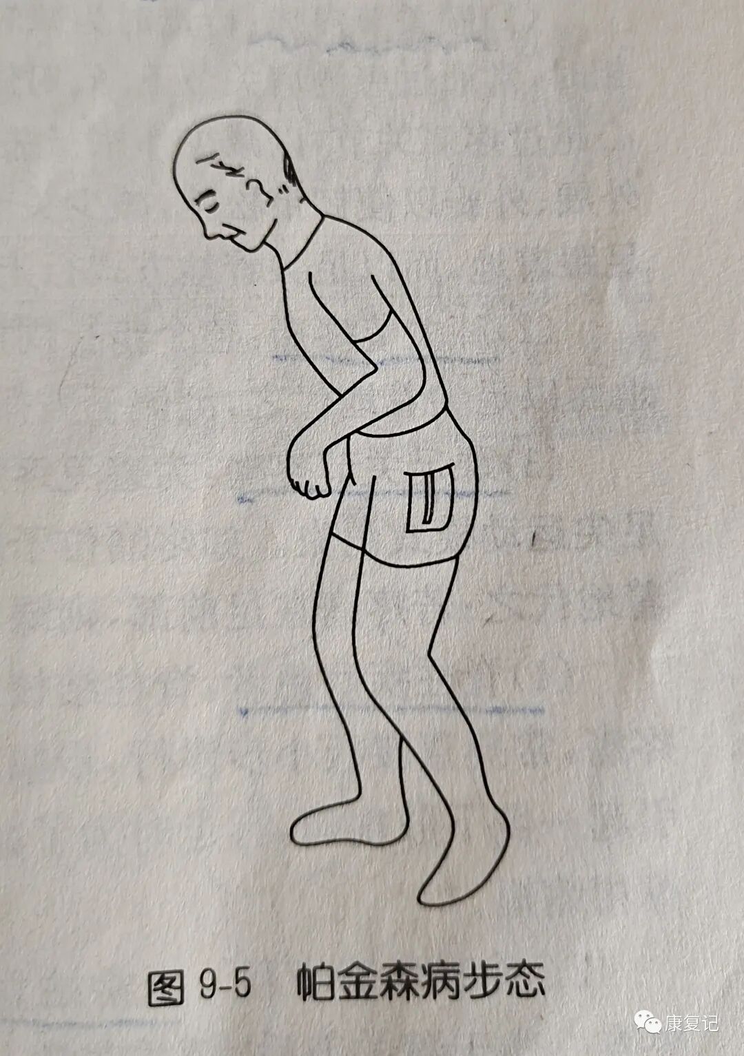 步态分析上曲线怎么解读康复知识点总结第47期——步态分析_https://www.jmylbn.com_新闻资讯_第7张