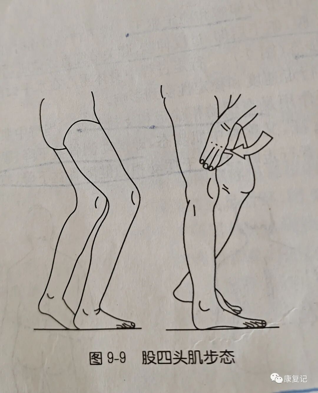 步态分析上曲线怎么解读康复知识点总结第47期——步态分析_https://www.jmylbn.com_新闻资讯_第10张