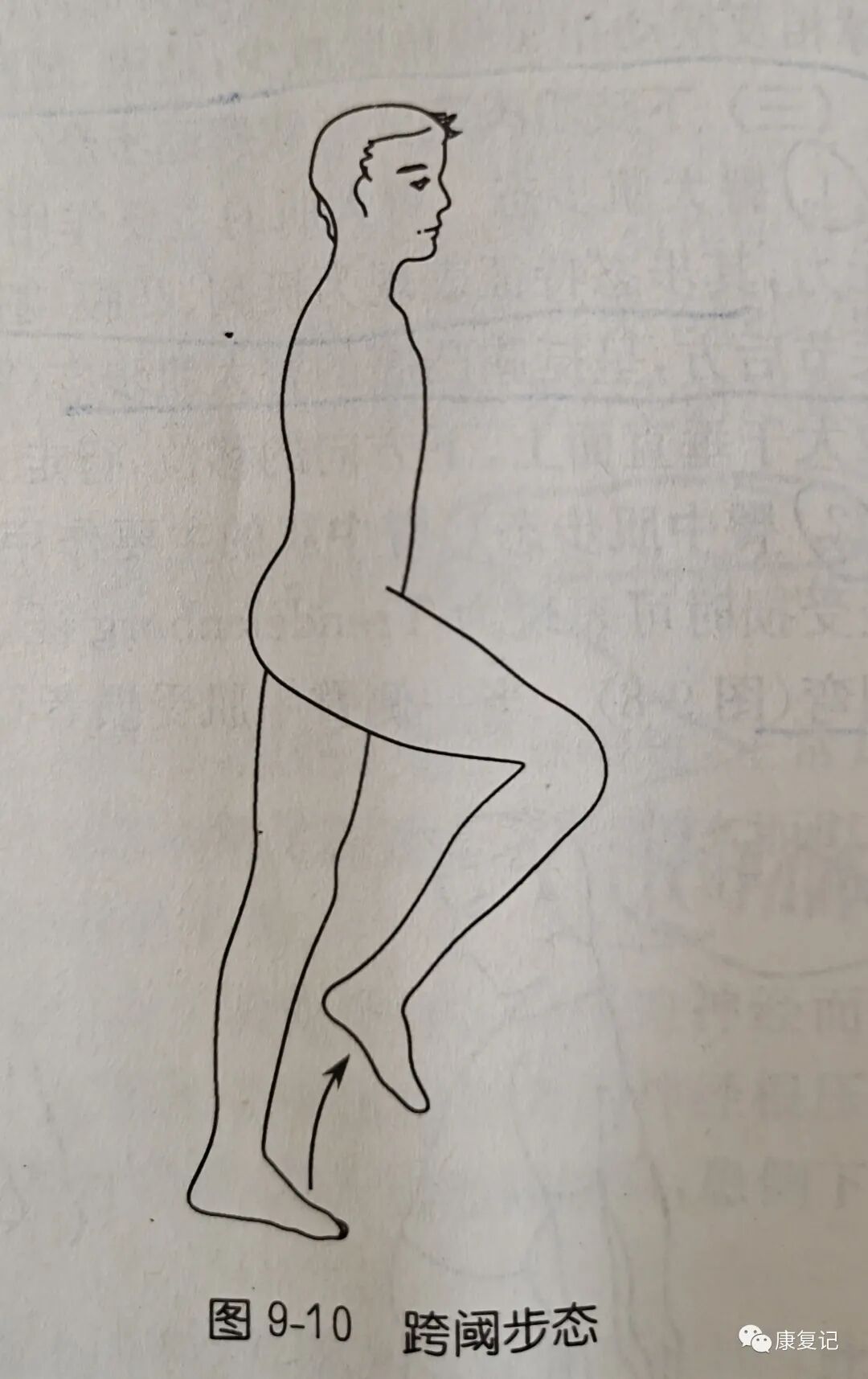步态分析上曲线怎么解读康复知识点总结第47期——步态分析_https://www.jmylbn.com_新闻资讯_第11张