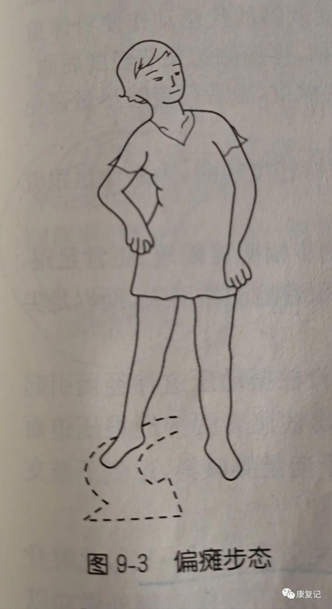 步态分析上曲线怎么解读康复知识点总结第47期——步态分析_https://www.jmylbn.com_新闻资讯_第5张