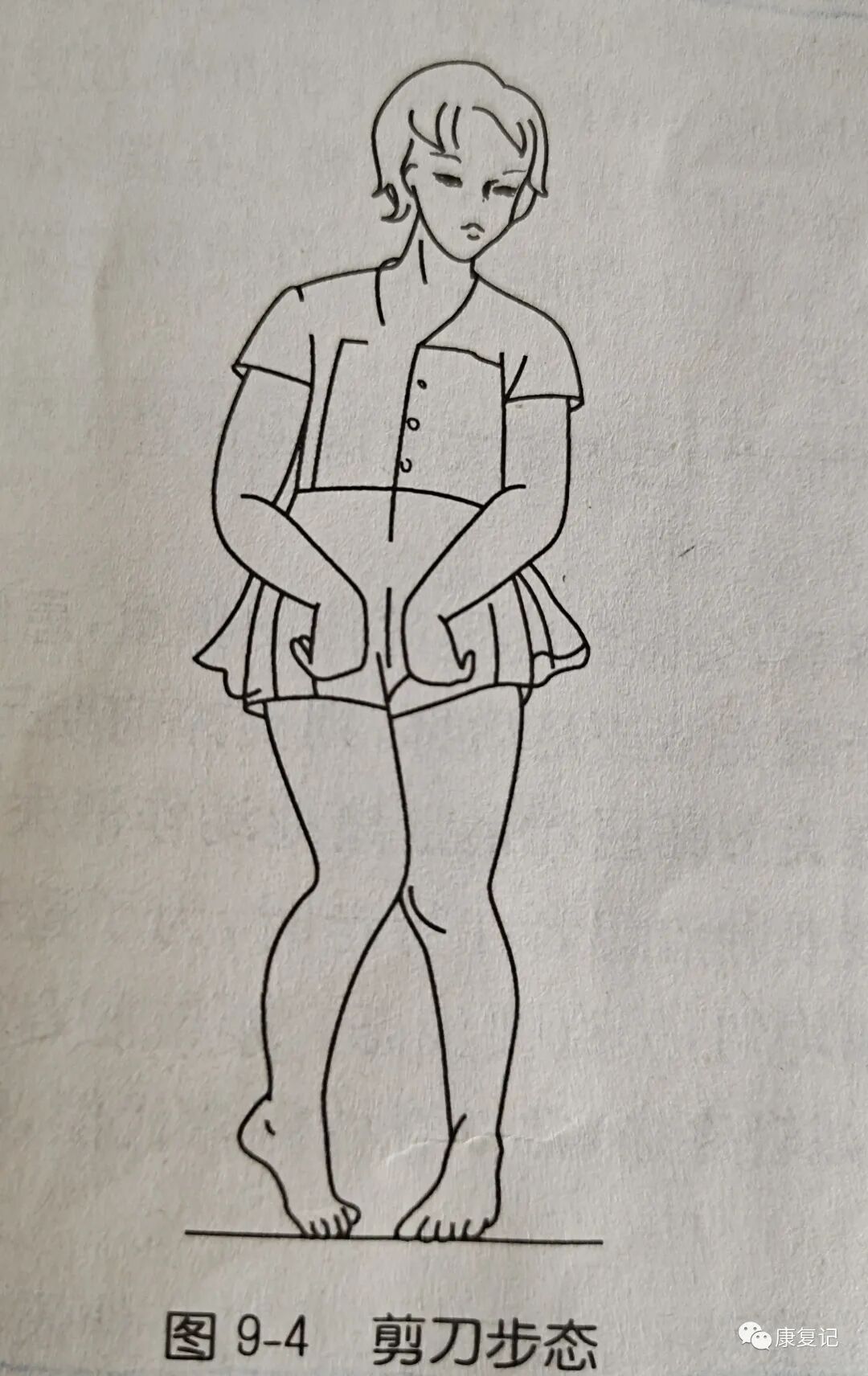 步态分析上曲线怎么解读康复知识点总结第47期——步态分析_https://www.jmylbn.com_新闻资讯_第6张