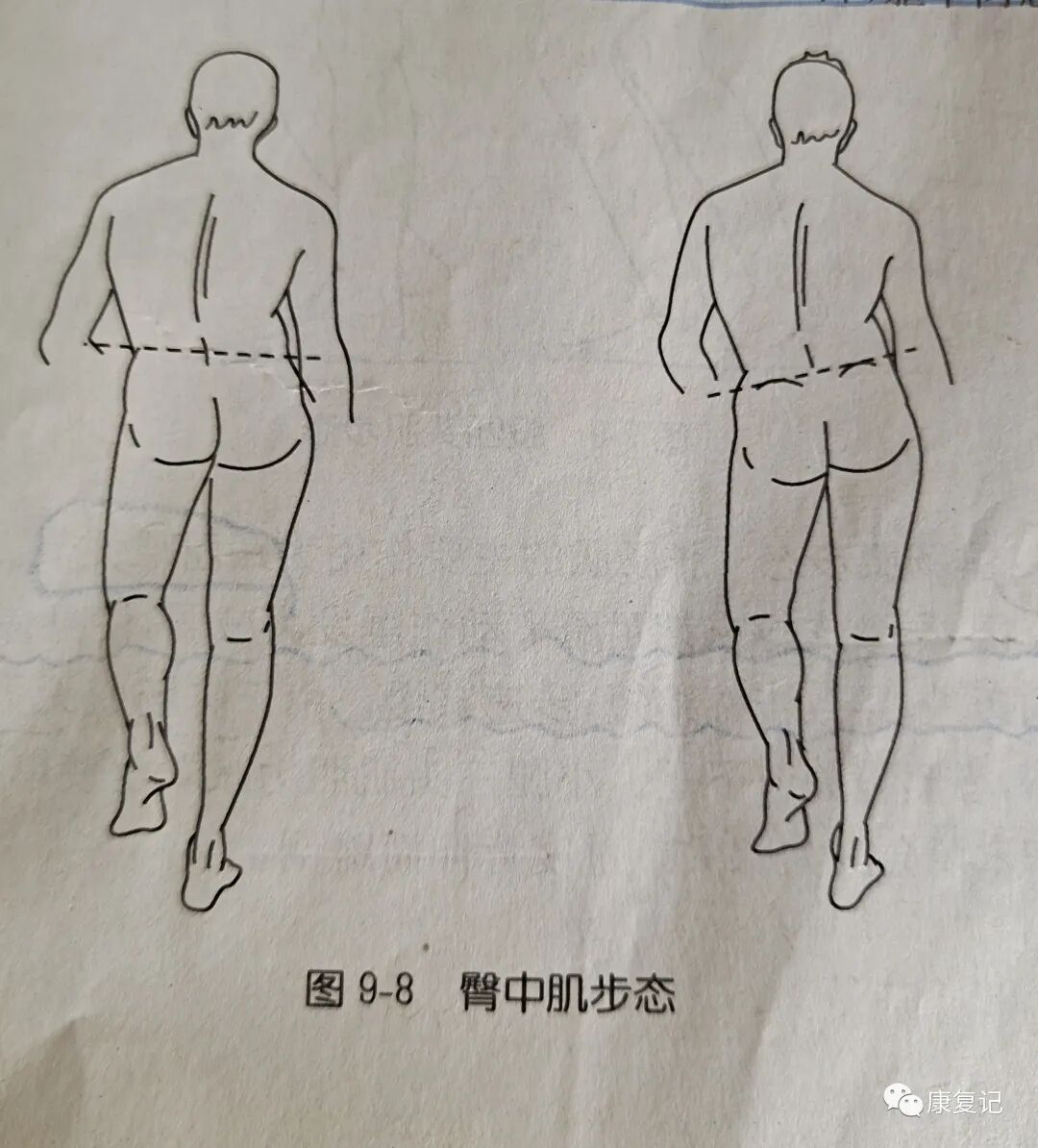 步态分析上曲线怎么解读康复知识点总结第47期——步态分析_https://www.jmylbn.com_新闻资讯_第9张