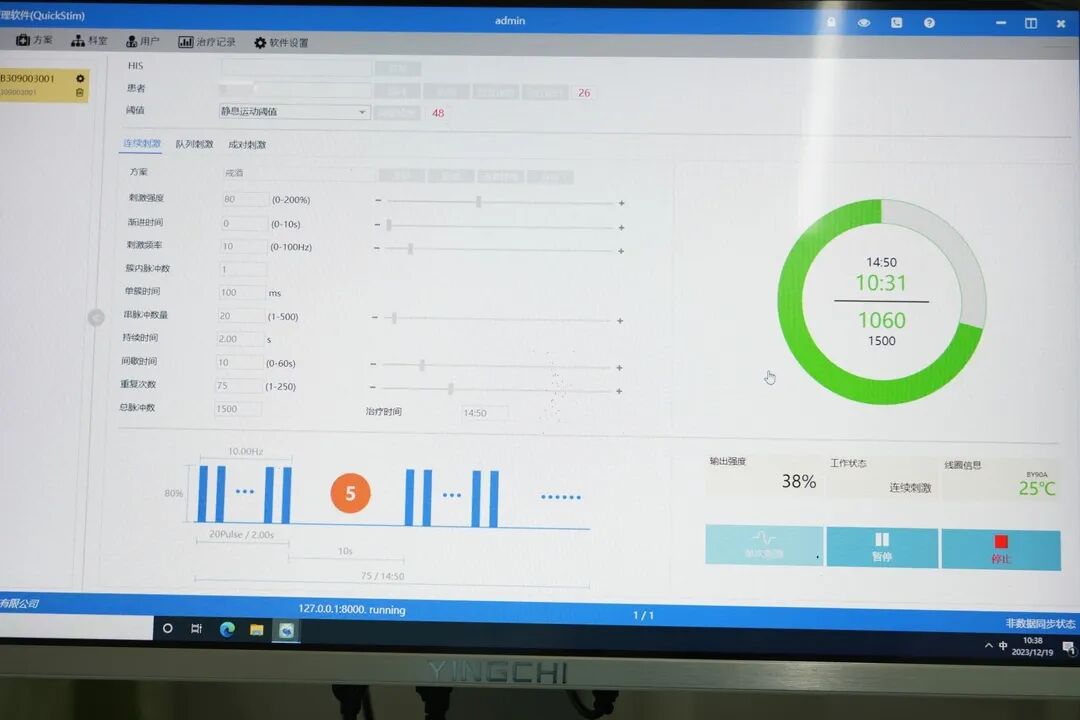 经颅磁治疗怎么样经颅磁刺激治疗仪——精神障碍疾病物理治疗新“利器”_https://www.jmylbn.com_新闻资讯_第4张