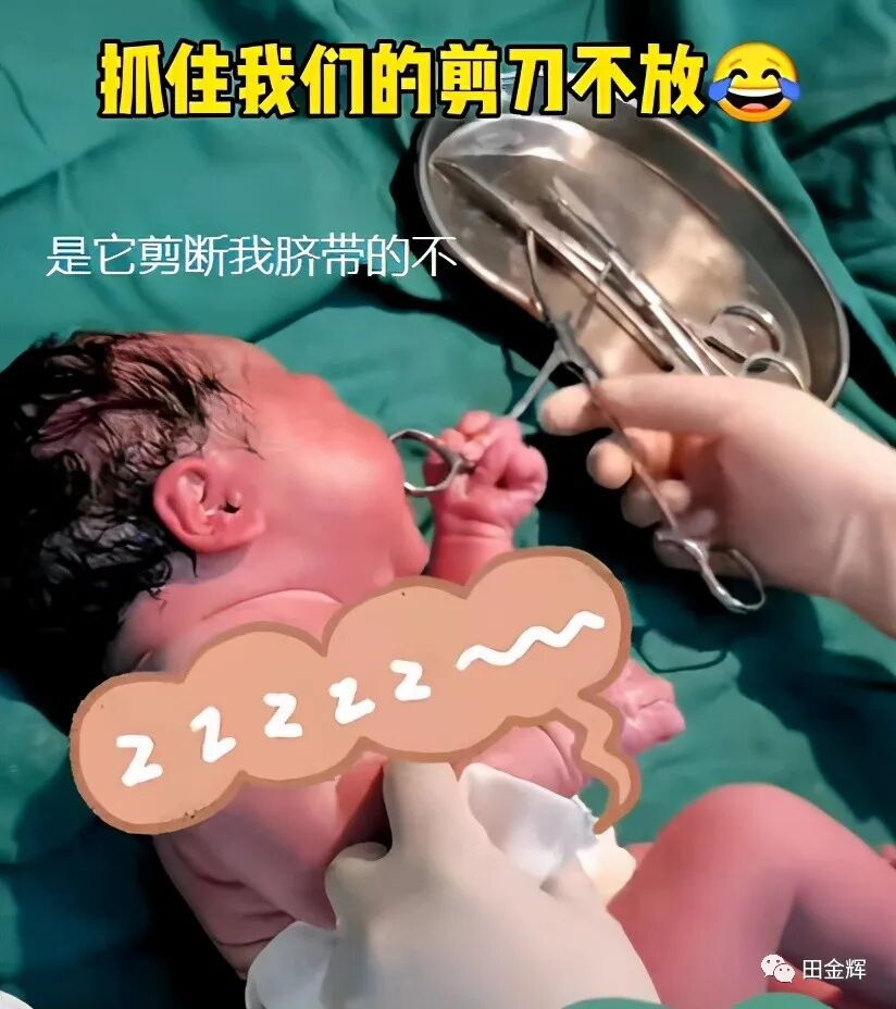 为什么剪脐带要先夹住【孕校素材】新生儿出生后抓住剪子不松手，被抢走后放声大哭，剪脐带会痛吗？_https://www.jmylbn.com_新闻资讯_第3张