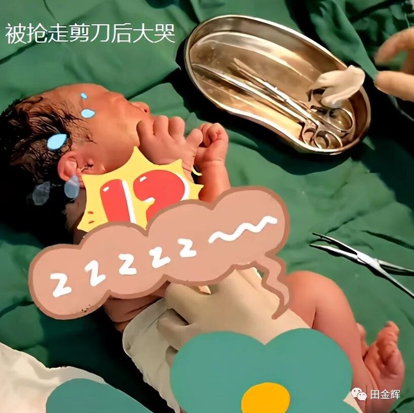 为什么剪脐带要先夹住【孕校素材】新生儿出生后抓住剪子不松手，被抢走后放声大哭，剪脐带会痛吗？_https://www.jmylbn.com_新闻资讯_第4张