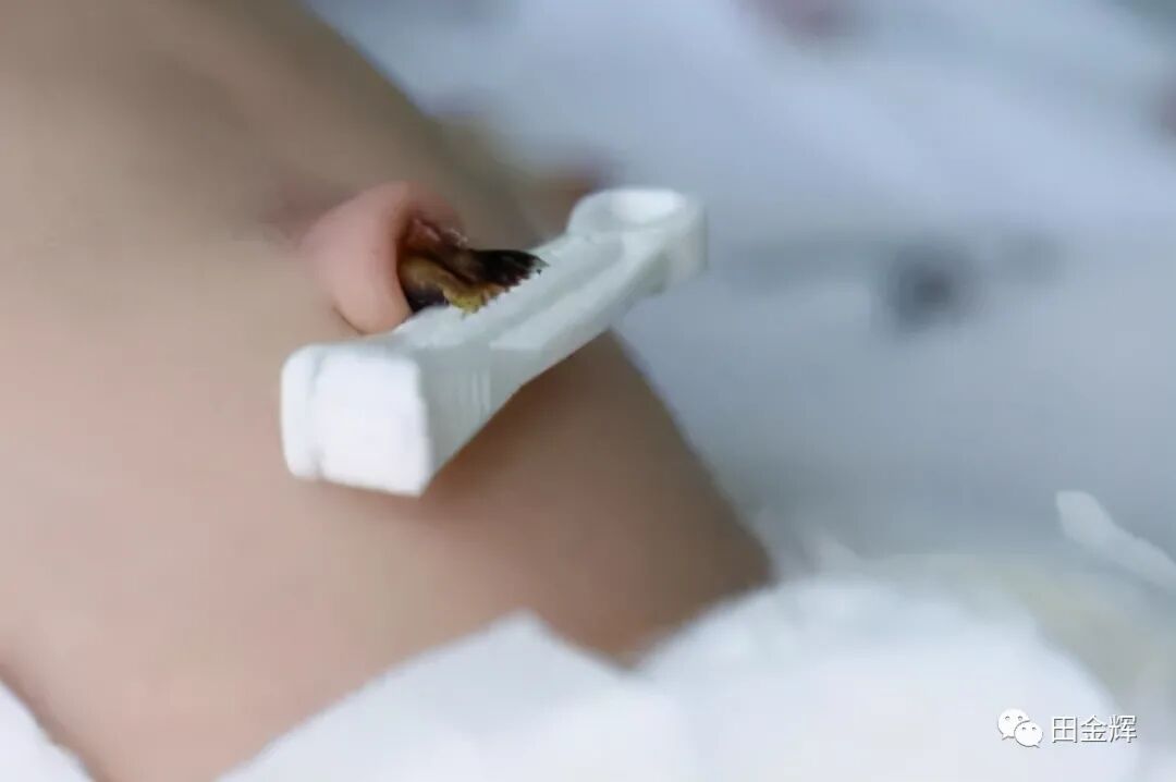 为什么剪脐带要先夹住【孕校素材】新生儿出生后抓住剪子不松手，被抢走后放声大哭，剪脐带会痛吗？_https://www.jmylbn.com_新闻资讯_第8张