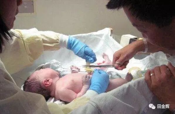 为什么剪脐带要先夹住【孕校素材】新生儿出生后抓住剪子不松手，被抢走后放声大哭，剪脐带会痛吗？_https://www.jmylbn.com_新闻资讯_第5张