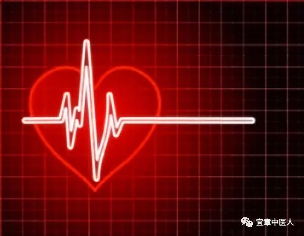 心电监护f n是什么心电监护看不懂？5点教你轻松玩转_https://www.jmylbn.com_新闻资讯_第4张