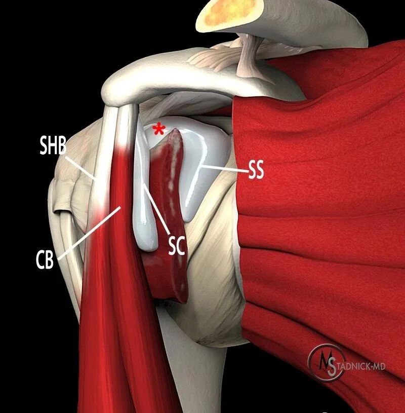 肩关节磁共振（MRI）经典解剖