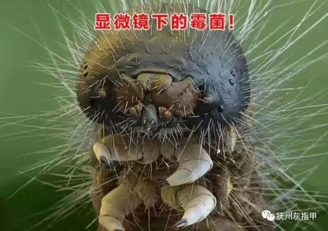 灰指甲和手足癣的真菌长什么样？