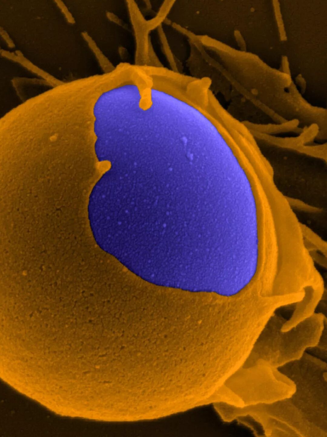 6park Com 假如病毒感染了ta