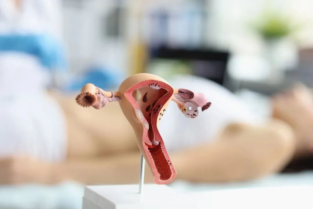 b超md是什么意思阴道出血10天！竟是它在“搞鬼”，定期B超很重要！_https://www.jmylbn.com_新闻资讯_第9张