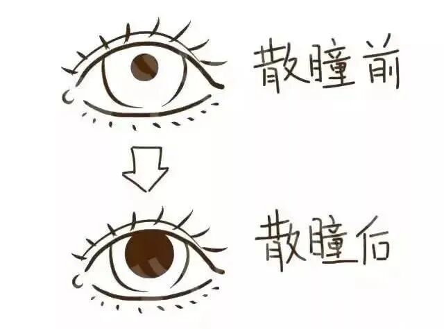 眼底激光机有什么牌子眼底检查“神器”！免扩瞳、0.4秒完成眼底照相，等你体验~_https://www.jmylbn.com_新闻资讯_第2张