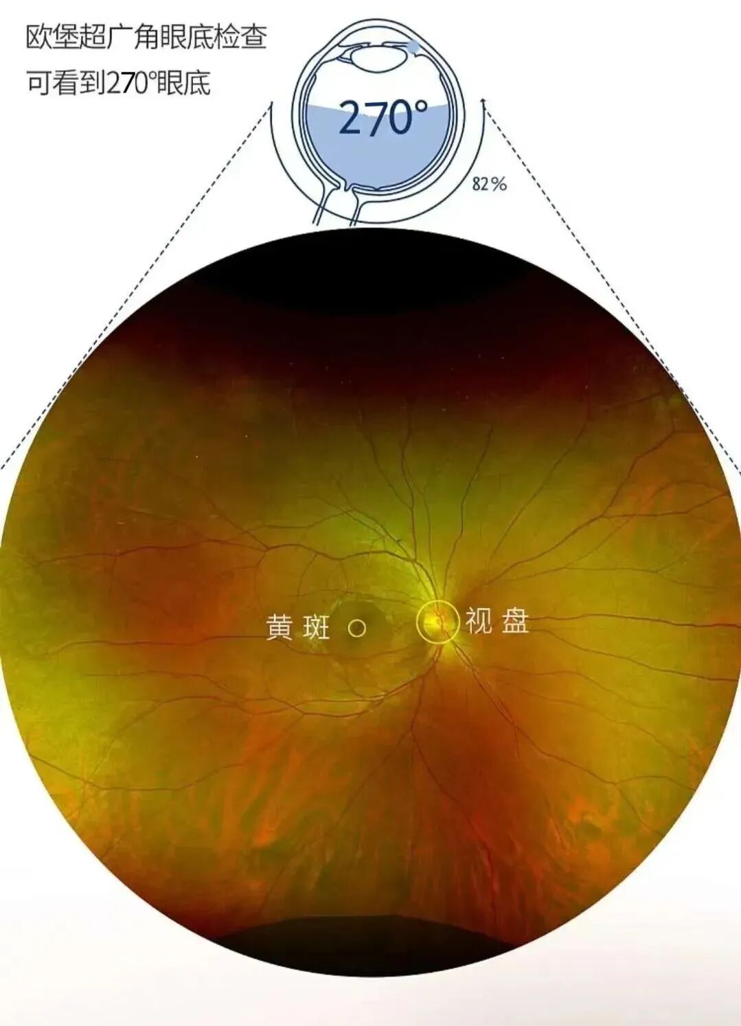 眼底激光机有什么牌子眼底检查“神器”！免扩瞳、0.4秒完成眼底照相，等你体验~_https://www.jmylbn.com_新闻资讯_第17张