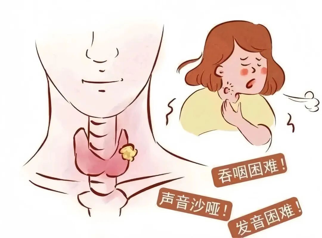 喉镜怎么不能无痛害怕喉镜检查？来试试无痛的！_https://www.jmylbn.com_新闻资讯_第2张