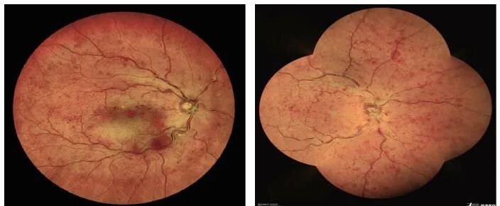 眼底照相有什么用眼底拍张照，眼病早知道！你的眼睛需要拍照吗？_https://www.jmylbn.com_新闻资讯_第10张