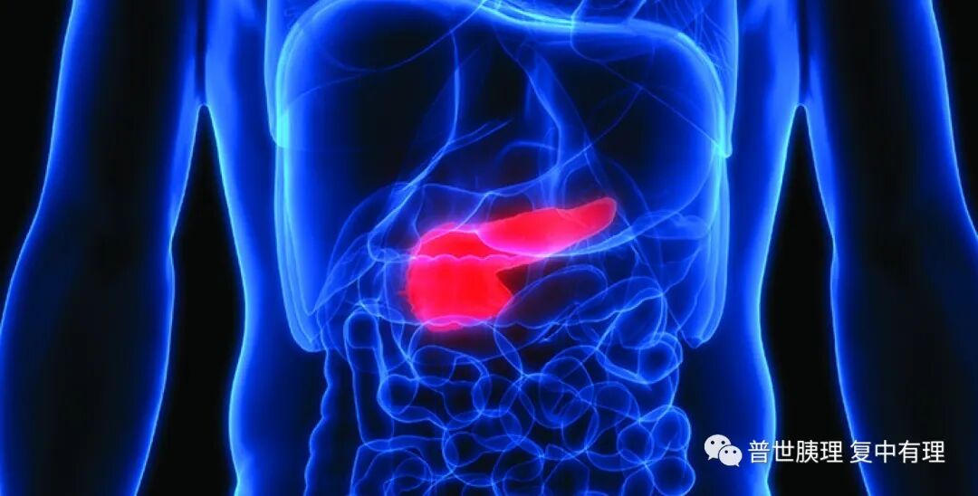 胰腺癌综合治疗系列丨初次发现往往就是晚期，为什么胰腺癌被称为癌中之王？