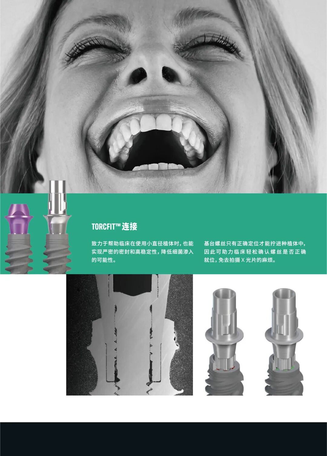 【CDS系列展商介绍】Straumann® BLX种植系统-为“即刻种植”而生-搜博