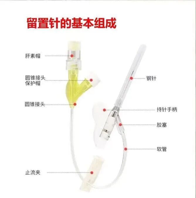 为什么输血不能用小针麻醉科手术室“针”不一样_https://www.jmylbn.com_新闻资讯_第4张