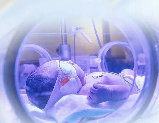 为什么要用光疗纸尿裤【科普】不用住院也能照蓝光！桓台妇幼新生儿科可以进行门诊蓝光治疗啦!_https://www.jmylbn.com_新闻资讯_第19张