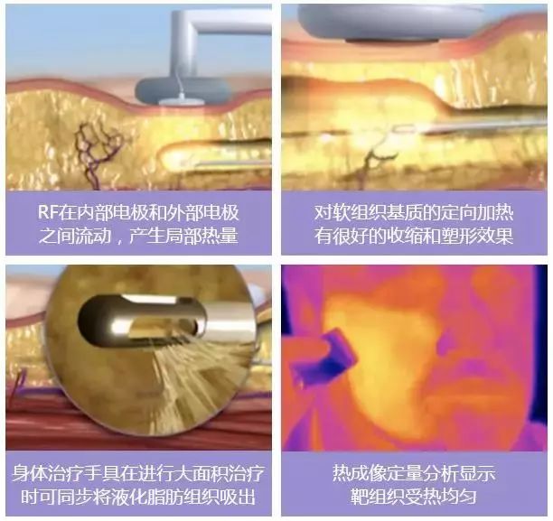 瘦身黑科技！小姐姐都在安利的減肥神器... 健康 第3張