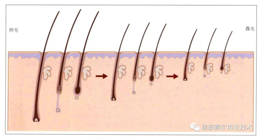 科普男性脱发的原因