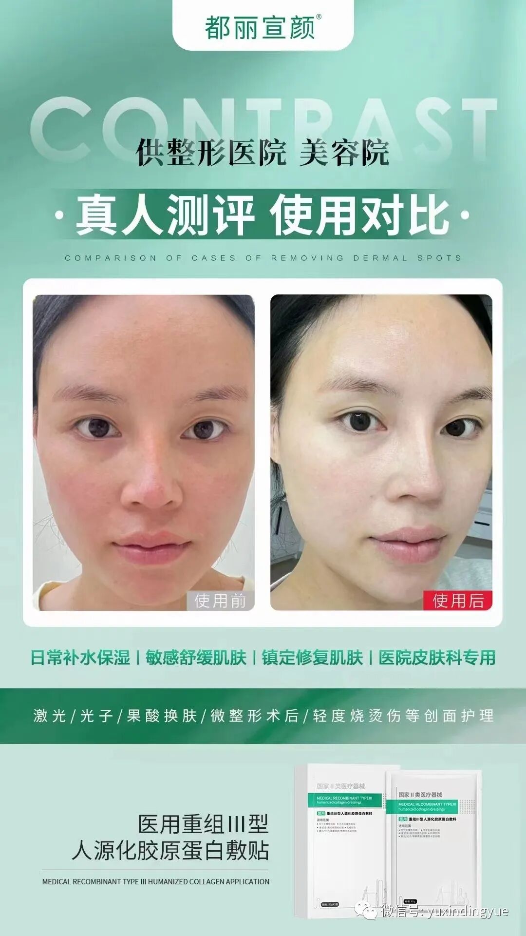 医用冷敷敷料怎么样医用面膜VS普通面膜到底有什么区别？_https://www.jmylbn.com_新闻资讯_第4张