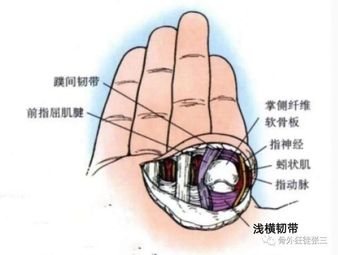 罕见病：掌指关节绞索