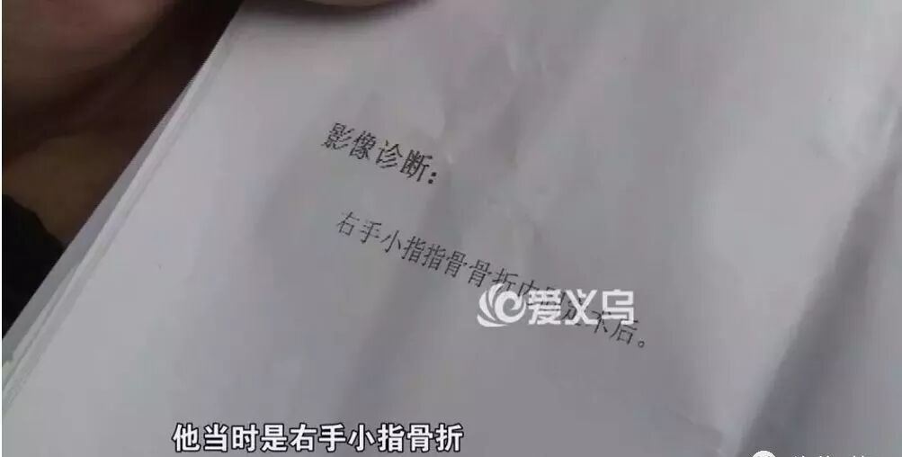 小徐工作时被汽车上的变速箱压到 右手小指,随后被送到了医院急诊室
