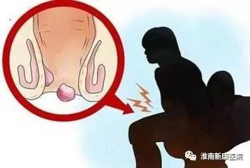 痔疮套扎吻合器怎么用【新康新闻】告别痔疮  健康首选——淮南新康医院成功开展世界领先技术“痔疮套扎吻合术”（RPH-4）_https://www.jmylbn.com_新闻资讯_第10张