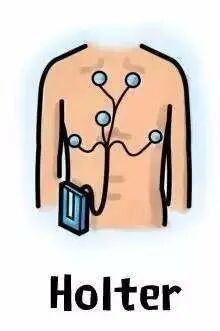 动态心电图怎么分析动态心电图，如何分析和诊断_https://www.jmylbn.com_新闻资讯_第1张