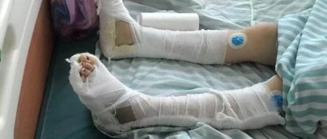 遭家暴跳楼女子已离婚！