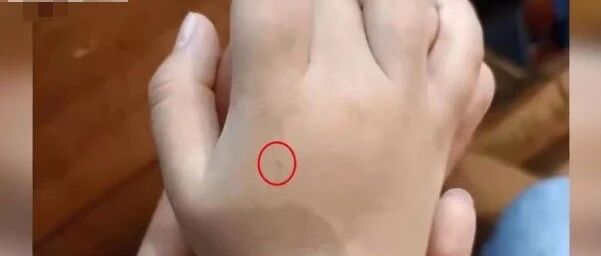 【8点见】保育员用针管扎4名幼儿手臂 官方通报