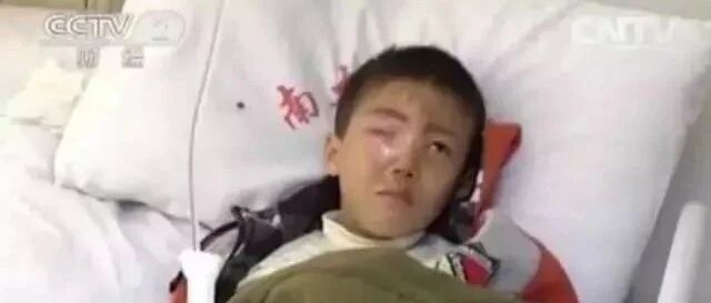 20分钟孩子眼球被溶化！医生说这东西每家都有，家长一定要高度警惕！